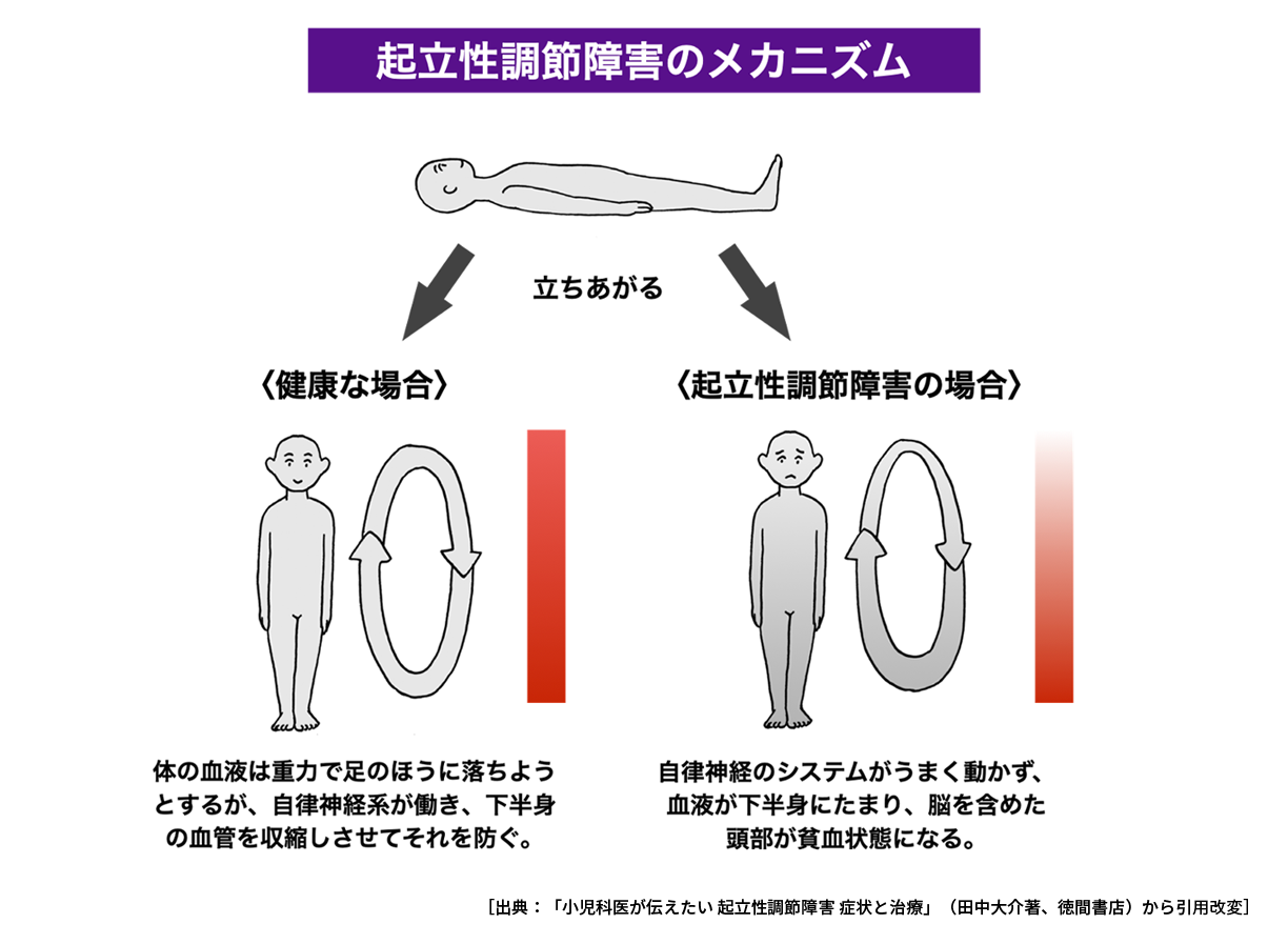 起立性調節障害のメカニズムイメージ