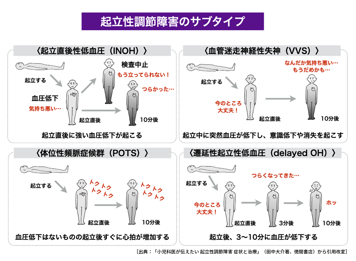 起立性調節障害のメカニズムイメージ